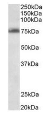 TSPYL2 antibody