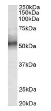TRIM11 antibody