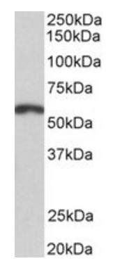 PAX3 antibody