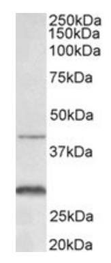 Cxcr2 antibody