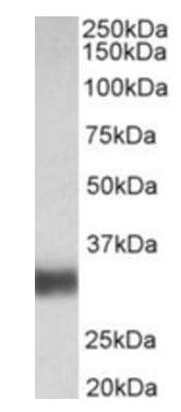 Goat anti-SFTPA1 / SFTPA2 (aa102-115) Antibody