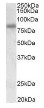 Goat anti-SDCCAG8 Antibody