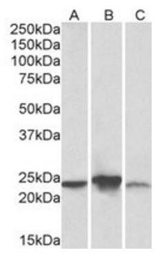 Goat anti-ABHD14B (aa188-200) Antibody