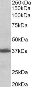Goat anti-AIMP1 / SCYE1 (aa137-149), Biotinylated Antibody