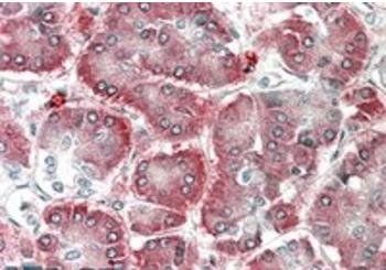 Goat anti-AIMP1 / SCYE1 (aa137-149) Antibody