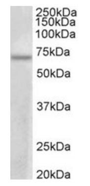 Goat anti-PRMT3 (aa468-421) Antibody