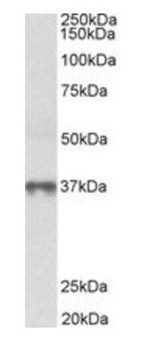 Goat anti-MAT2B (isoform 1) Antibody