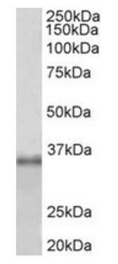 Goat anti-Fibrillarin / FBL Antibody