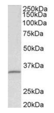 Goat anti-fibrillarin / FBL (aa99-110) Antibody
