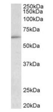 Goat anti-HIC2 (aa188-200) Antibody