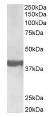 Goat anti-Endophilin-A1 / SH3GL2 Antibody
