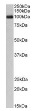 Goat anti-G-CSF receptor / CSF3R (aa551-563) Antibody