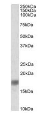 Goat anti-Alpha-synuclein (NACP140) Antibody