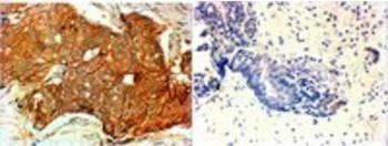 Goat anti-ERBB2 / HER2 Antibody