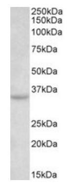 Goat anti-TSPAN5 / NET-4 Antibody