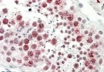 Goat anti-DNAJC5G (human) Antibody
