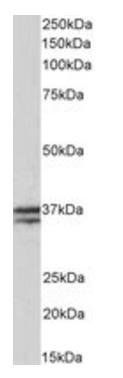 TNNT1 antibody