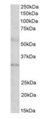 IGFBP1 antibody