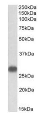 Goat anti-TNNI3 Antibody