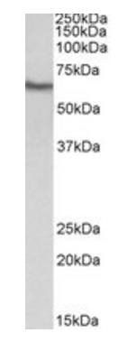 GGT1 antibody