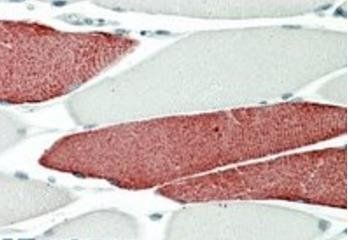 Goat anti-TNNT3 Antibody