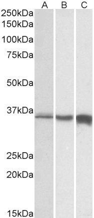 Goat anti-TNNT3, Biotinylated Antibody