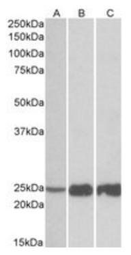 Goat anti-TNNI2 Antibody