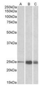 Goat anti-TNNI2 (aa83-95) Antibody