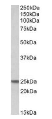 Goat anti-TNNI1 Antibody