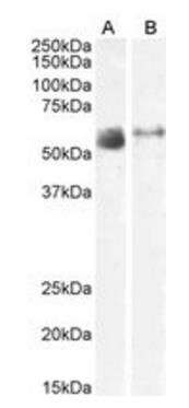 SLC7A7 antibody