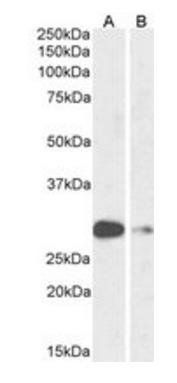 Goat anti-ASCL1 (aa79-91) Antibody