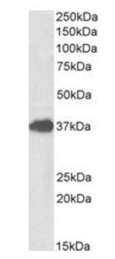 Goat anti-FOXF1 Antibody
