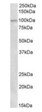 Goat anti-ENPP2 / AUTOTAXIN (aa698-712) Antibody
