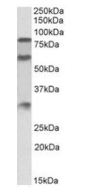 KNG1 antibody