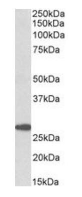 PTGDS antibody