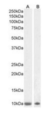 S100B antibody