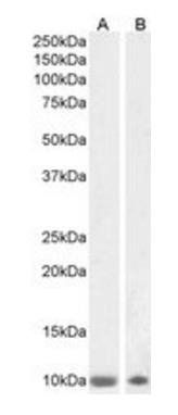 Goat anti-S100B Antibody