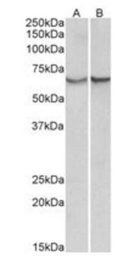 Goat anti-alpha-1-antichymotrypsin (aa222-236) Antibody