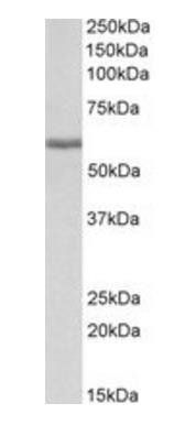 Fibrinogen beta antibody