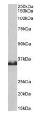 Goat anti-LDHB Antibody
