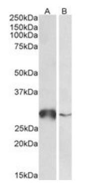 Goat anti-GSTO1 Antibody