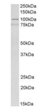 Goat anti-ACTN1 (aa596-609) Antibody