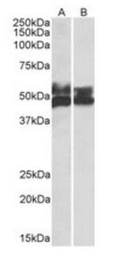 FCRL1 antibody