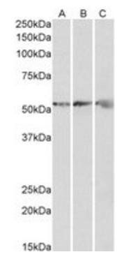 ATP5B antibody