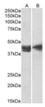 IL3RA antibody