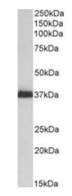 Goat anti-MSI2 / musashi-2 Antibody