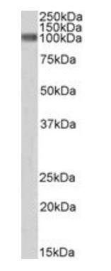 Goat anti-CTNNB1 / catenin beta-1 (aa108-121) Antibody