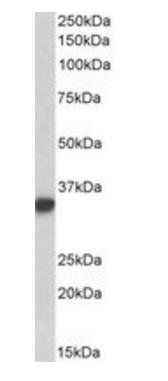 CD74 antibody