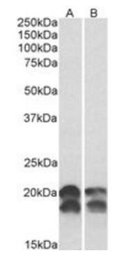 Goat anti-NME1 Antibody