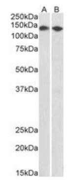 Goat anti-CCAR2 / DBC1 (aa842-855) Antibody